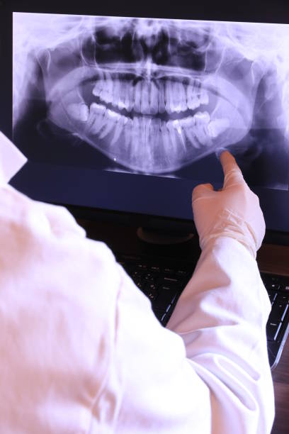 Best Emergency Tooth Extraction in La Presa, CA
