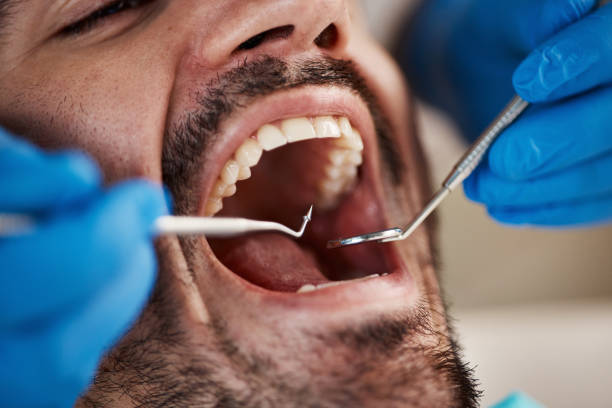Best Pediatric Emergency Dentist in La Presa, CA